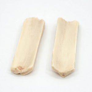 Tibial Cortical Struts