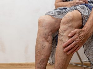 7zilne bolezni scaled e1770975609642