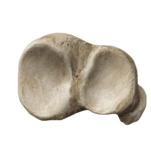 Tibia Condyle