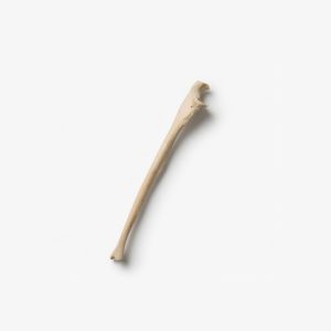 Radius / Ulna / Sternum / Patella